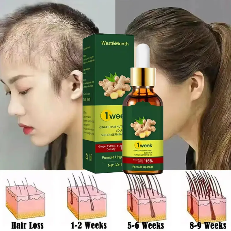 Licorice Root Sticks - 7 gün zencefil saç büyüme ürünleri