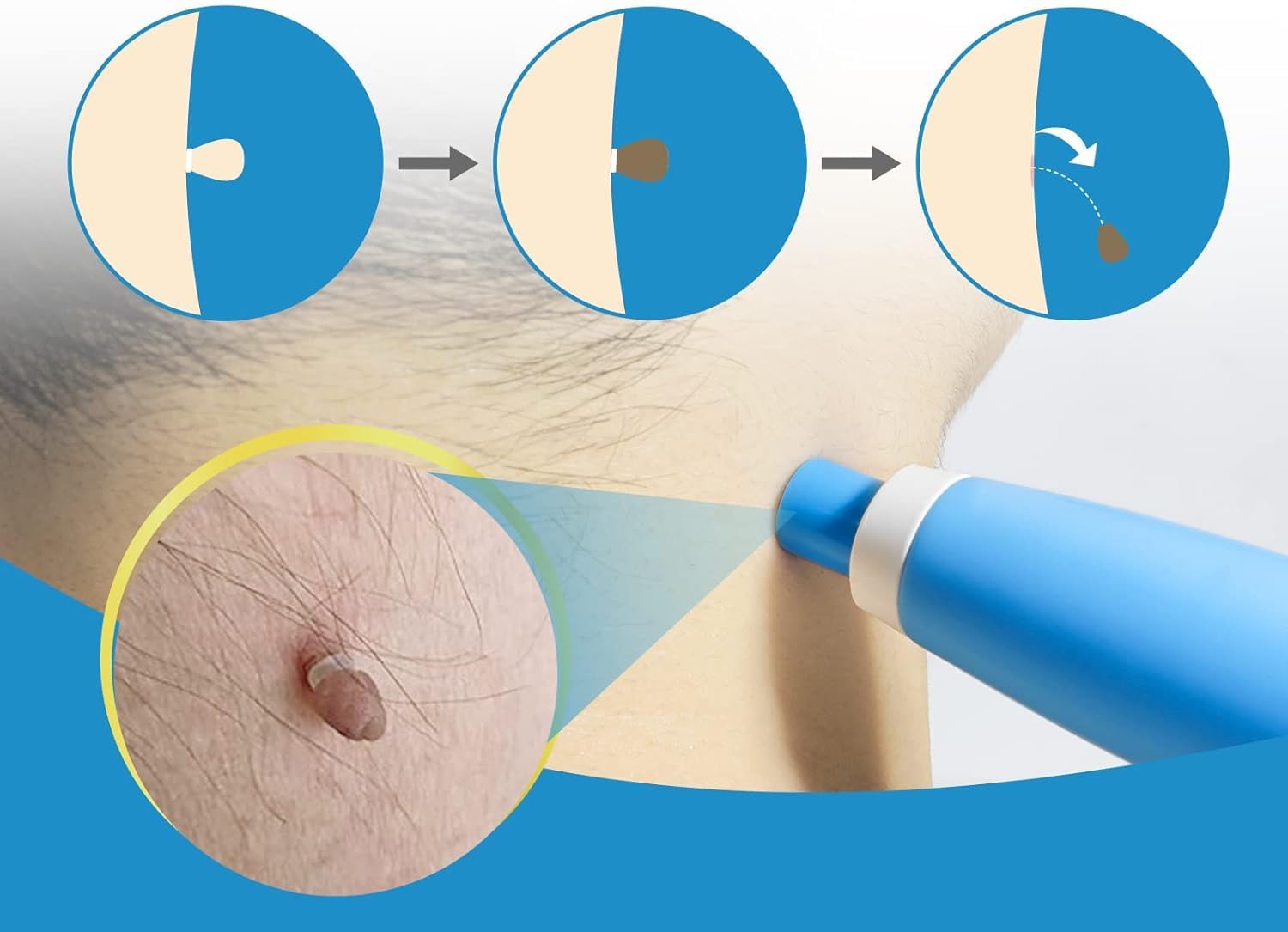 Ağrısız Otomatik Cilt Etiketi  - Health Wellness incelemesi ve fiyatı