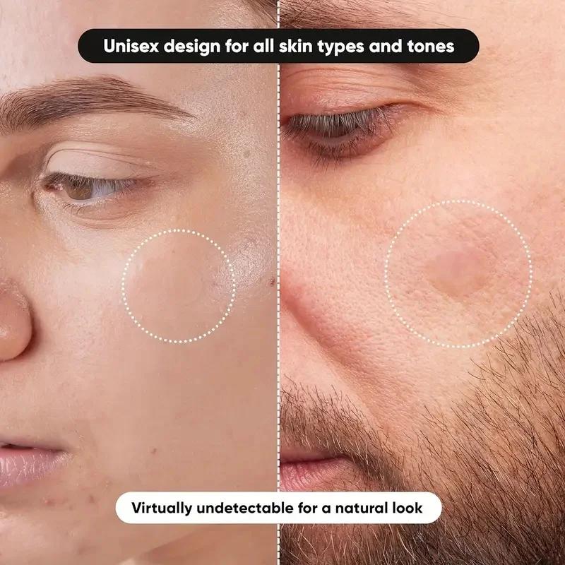 360 adet/kutu akne bantları -  - Essential Oils incelemesi ve fiyatı