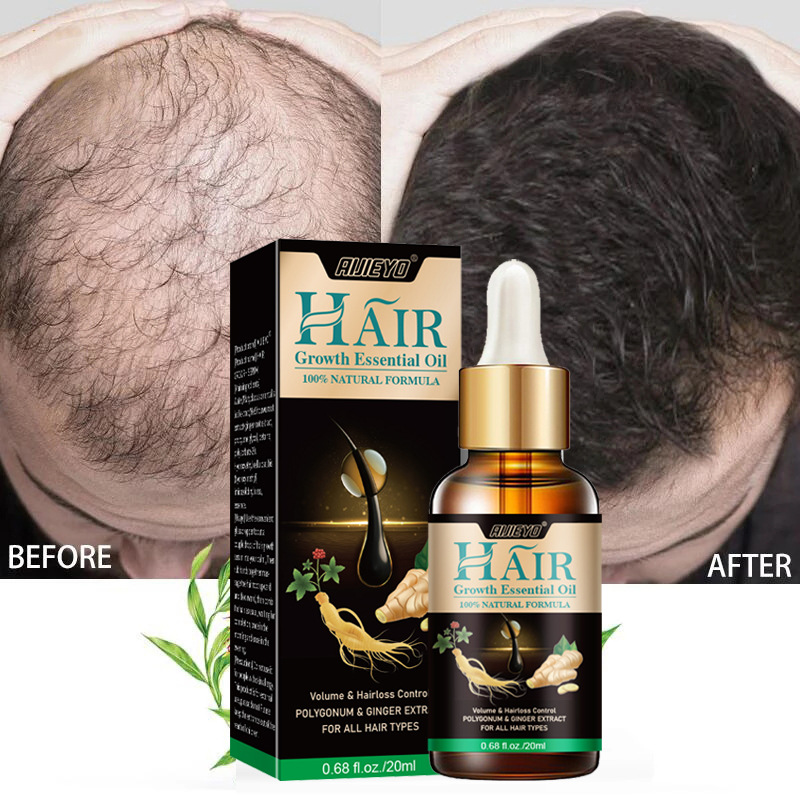 2023 Biotin Hızlı Saç Büyüme Y - Licorice Root Sticks incelemesi ve fiyatı