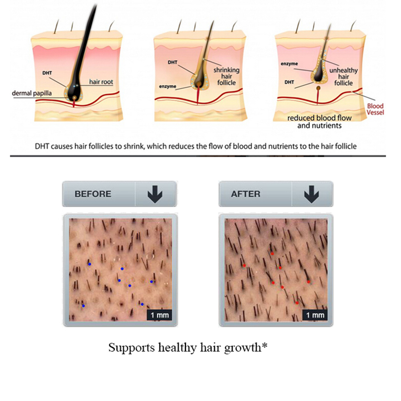 PURC 100ml zencefil saç dökülm - Licorice Root Sticks incelemesi ve fiyatı